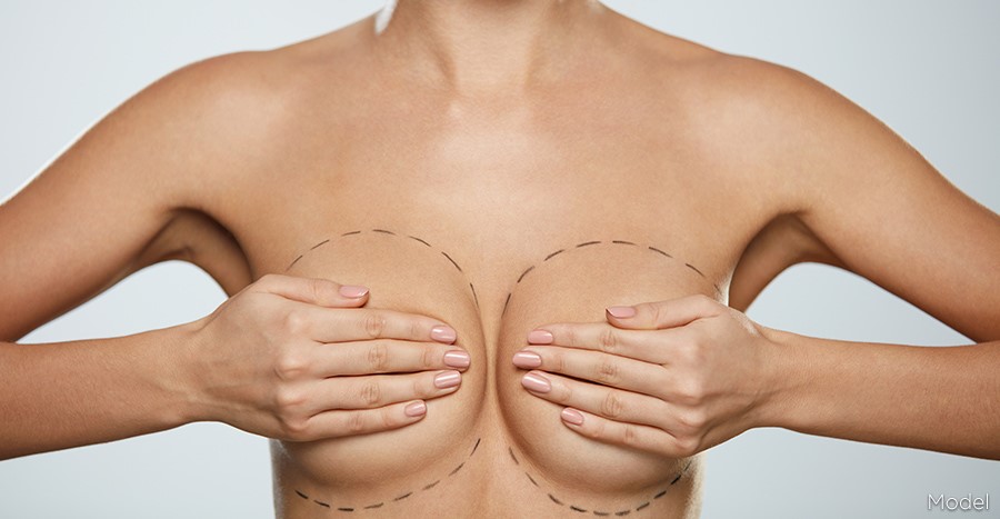 what is Mammoplasty ?