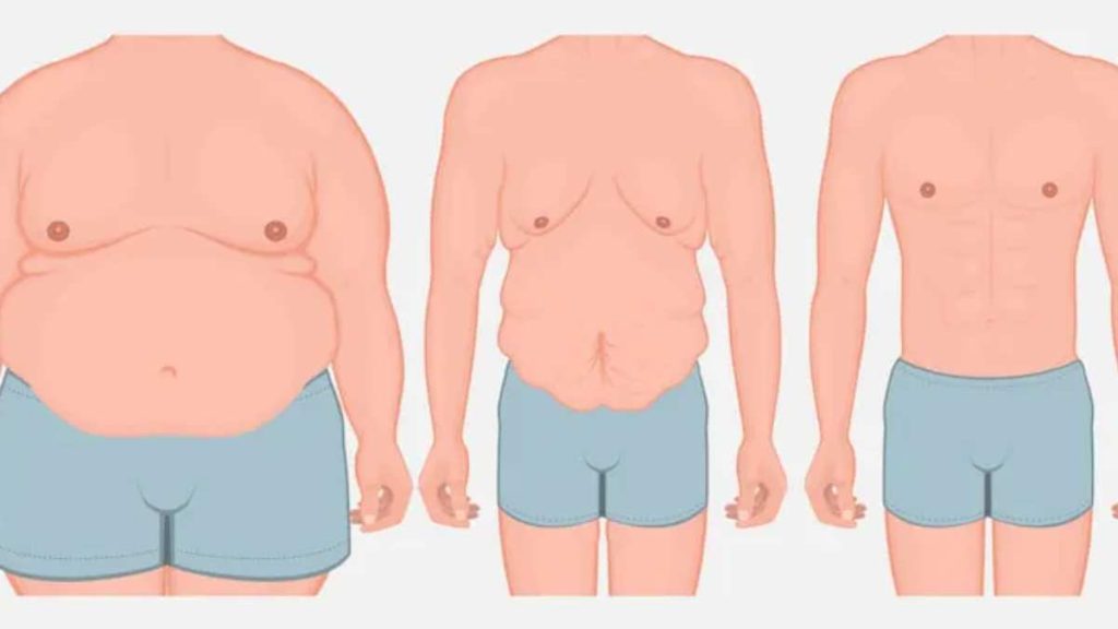 پیکرتراشی در کرج