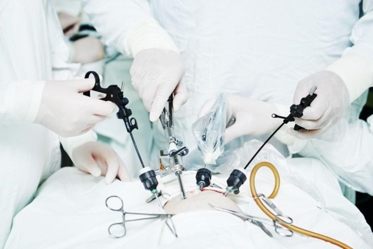 جراحی لاپاراسکوپی آپاندیس در کرج