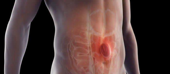 عمل جراحی فتق شکم