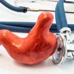 نظرات بیماران جراحی چاقی در کرج