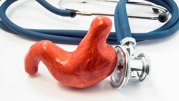 نظرات بیماران جراحی چاقی در کرج