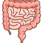 سرطان روده بزرگ